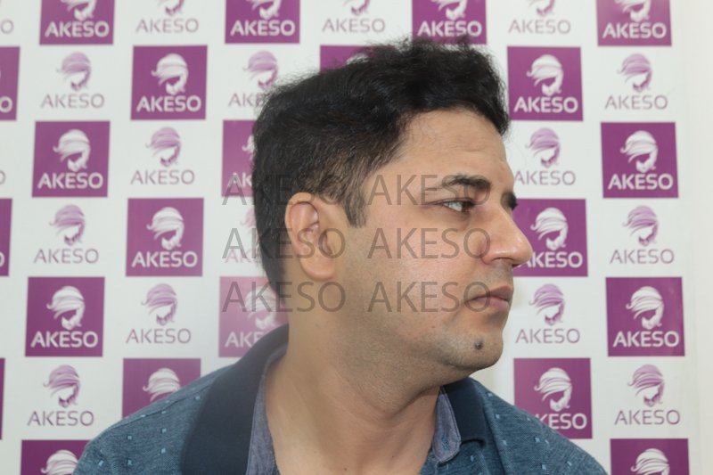 AKESO HAIR TRANSPLANT RESULTRANPQ.jpg