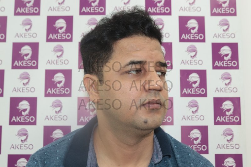 AKESO HAIR TRANSPLANT RESULTRANPS.jpg