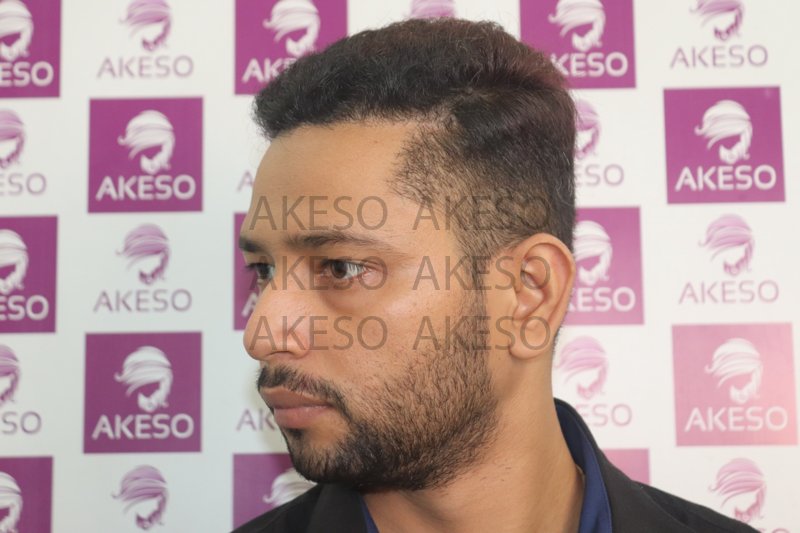 AKESO HAIR TRANSPLANT RESULTSANVHTG.jpg