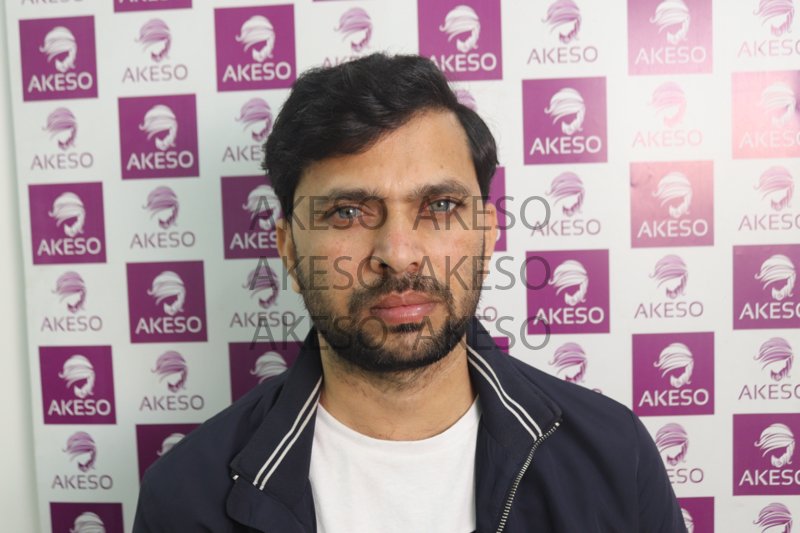 AKESO HAIR TRANSPLANT RESULT_GAUSI.jpg