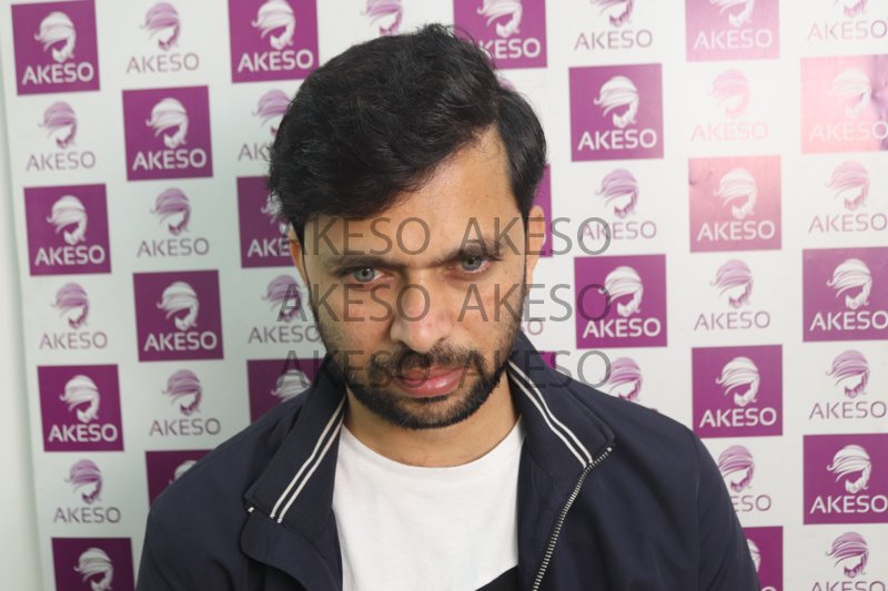 AKESO HAIR TRANSPLANT RESULT_GAUSJ.jpg