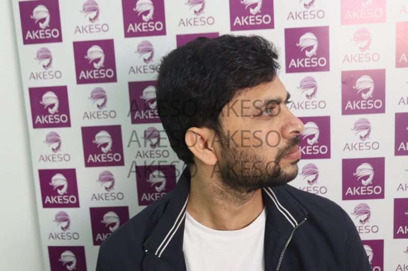 AKESO HAIR TRANSPLANT RESULT_GAUSP.jpg
