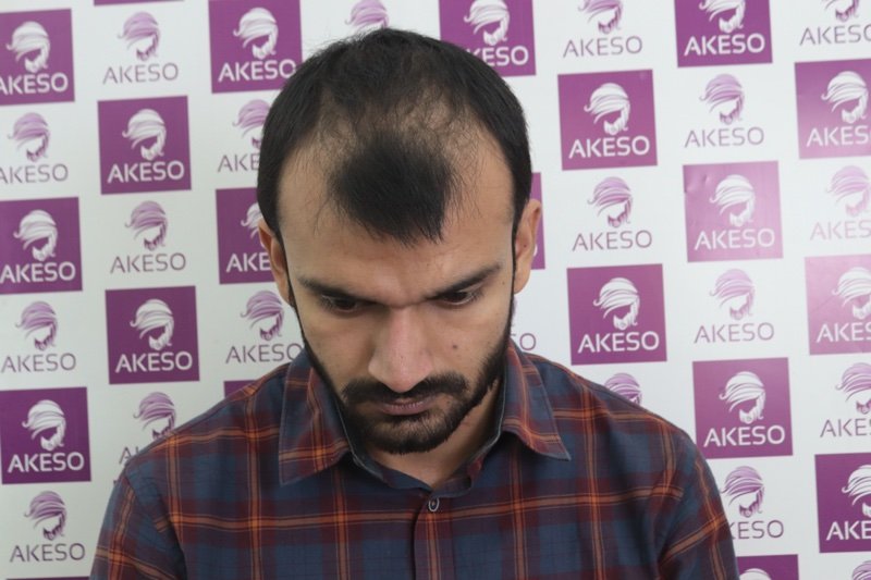 AKESO HT RESULT GAUPA2.jpg