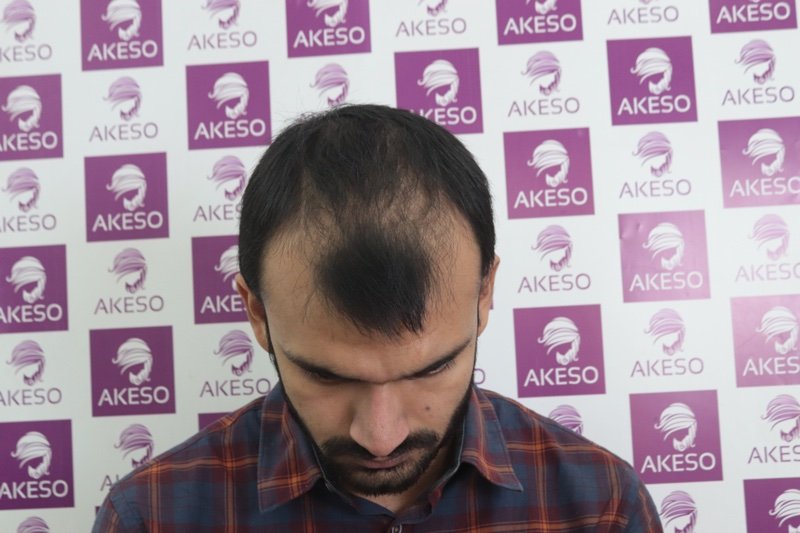 AKESO HT RESULT GAUPB.jpg