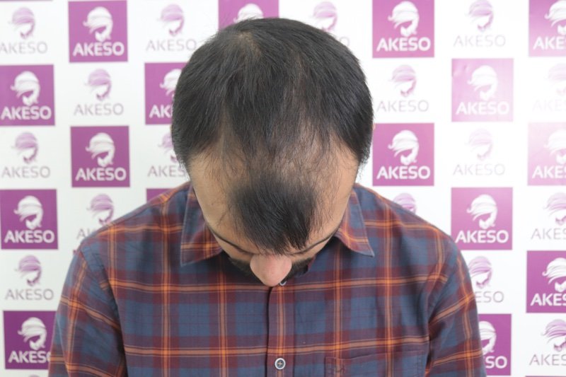 AKESO HT RESULT GAUPH.jpg