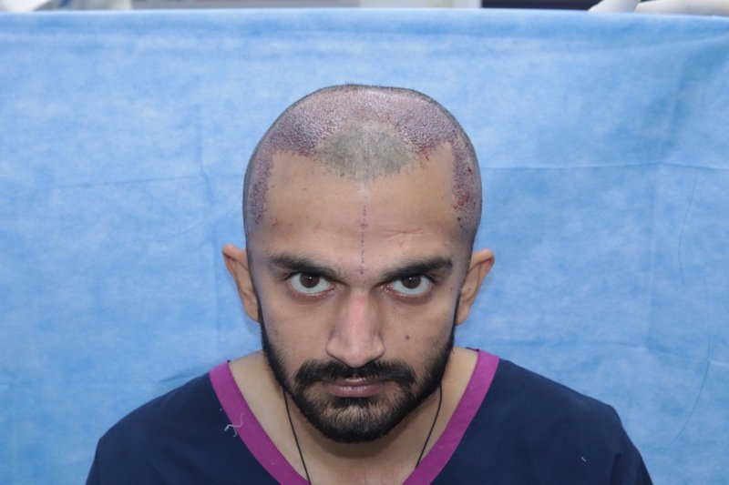AKESO HT RESULT GAUPI.jpg