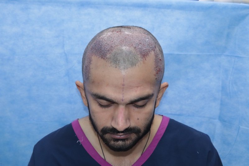 AKESO HT RESULT GAUPJ.jpg