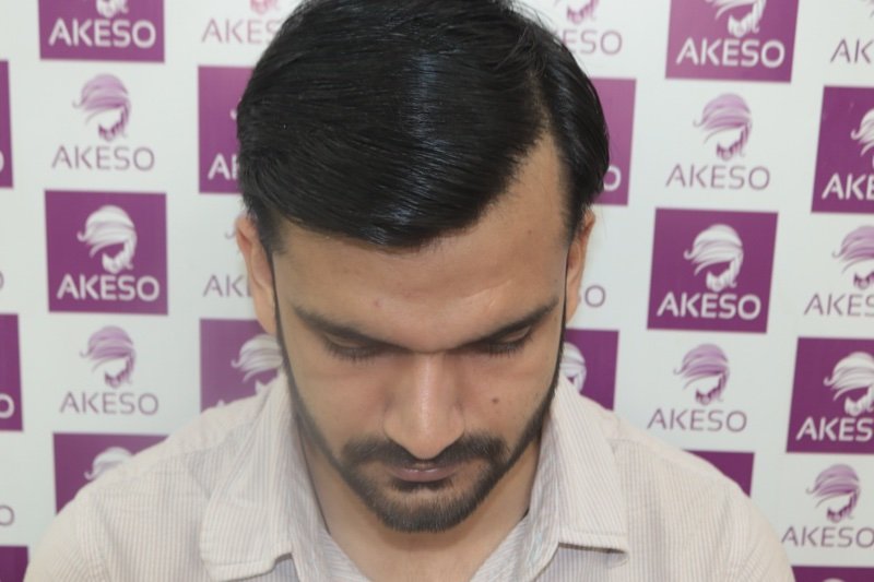 AKESO HT RESULT GAUPV.jpg