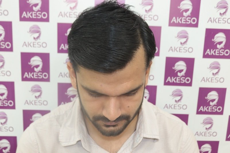 AKESO HT RESULT GAUPW.jpg