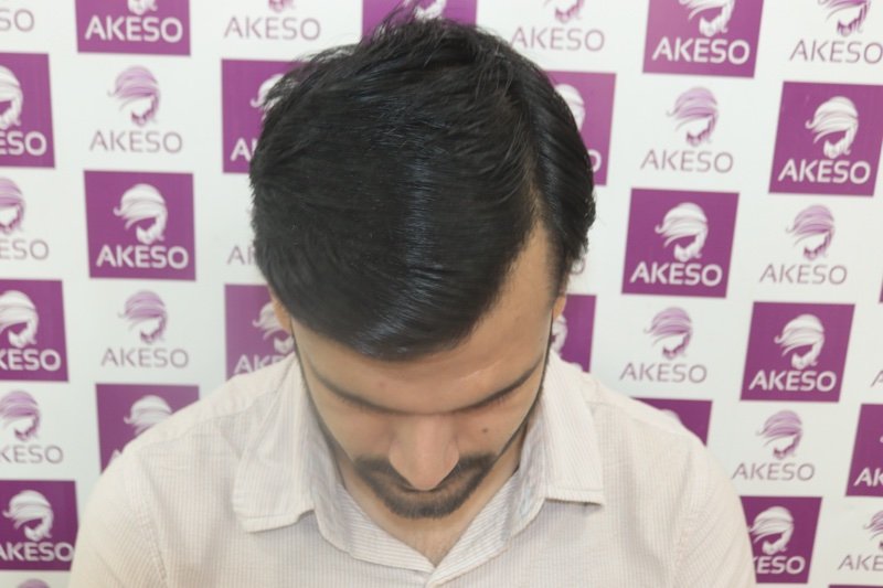 AKESO HT RESULT GAUPX.jpg